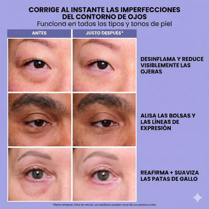 InfiniteLift | Gel tensor rejuvenecedor para tus ojos