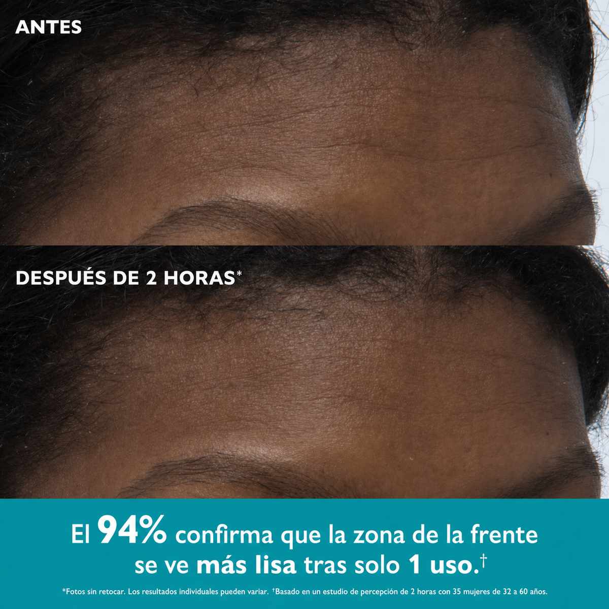 Cintas Faciales con Péptidos - Lifting Instantáneo Sin Cirugía
