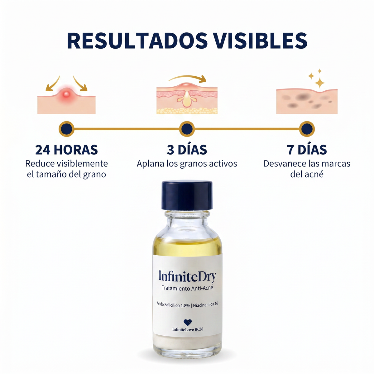 InfiniteDry - Tratamiento Anti-Acné