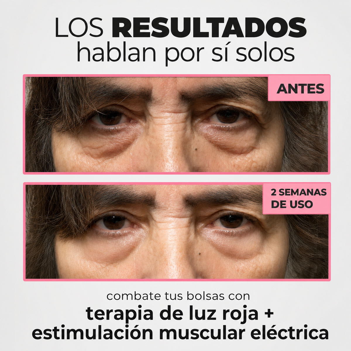 InfiniteEyes® — Terapia de Luz Roja + EMS para Eliminar Bolsas