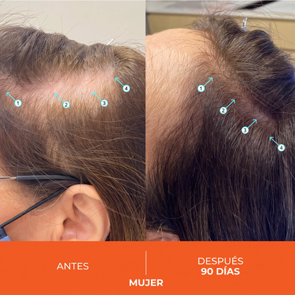 Shampoo Estimulante Capilar de Alto Rendimiento 205ml
