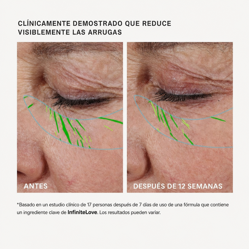 Infinite Love Bcn BioLift — Sérum Reafirmante con Péptidos y Ceramidas 30 ml