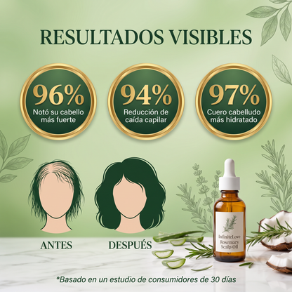 Aceite de Romero para Cuero Cabelludo - Tratamiento Capilar Nutritivo 30ml